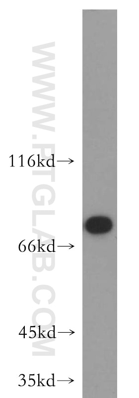 WB analysis of HeLa using 20078-1-AP