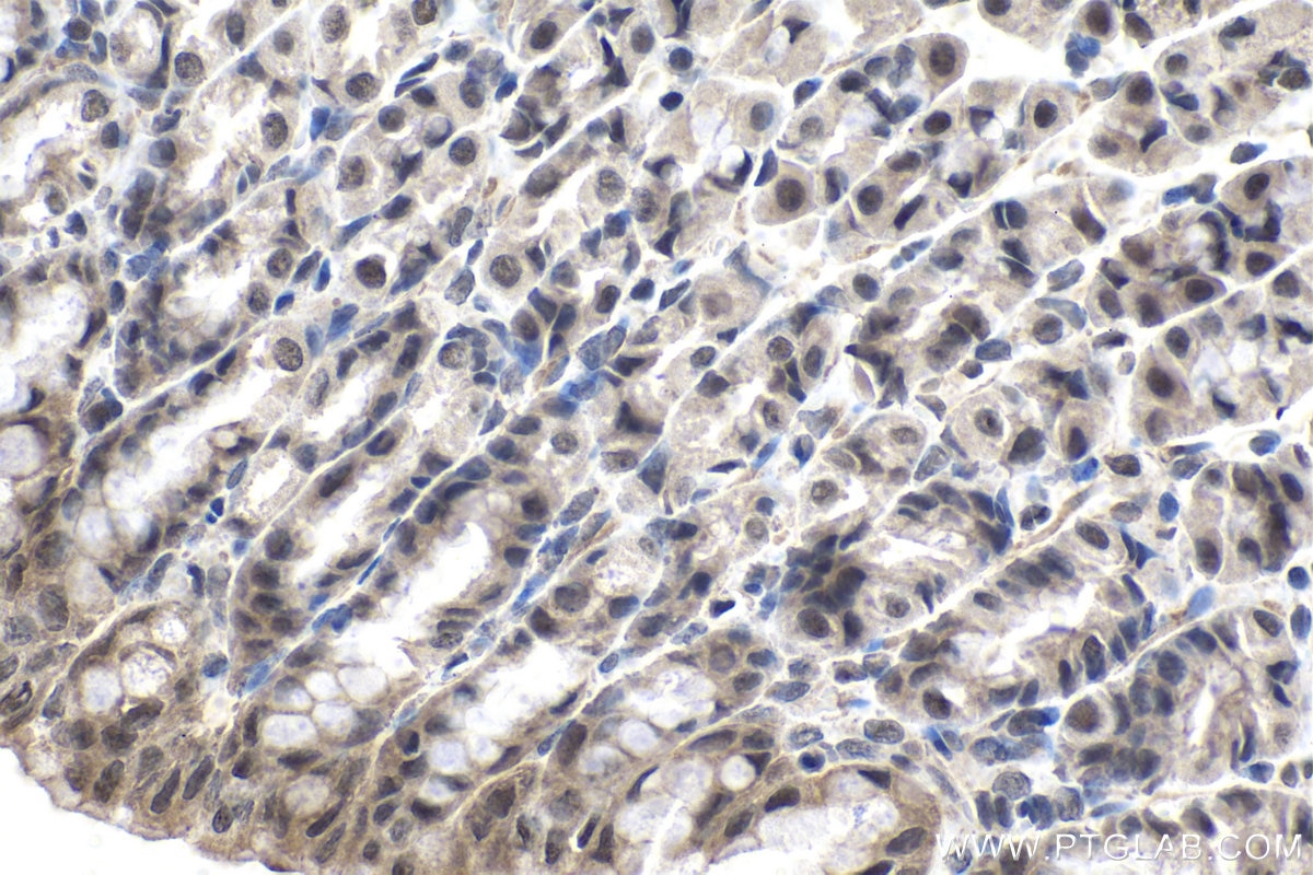 Immunohistochemistry (IHC) staining of rat stomach tissue using MYST2 Polyclonal antibody (13751-1-AP)
