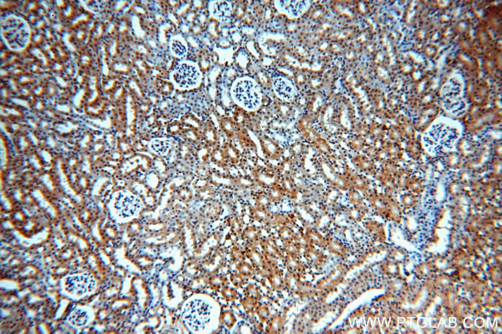 Immunohistochemistry (IHC) staining of mouse kidney tissue using MYST2 Polyclonal antibody (13751-1-AP)