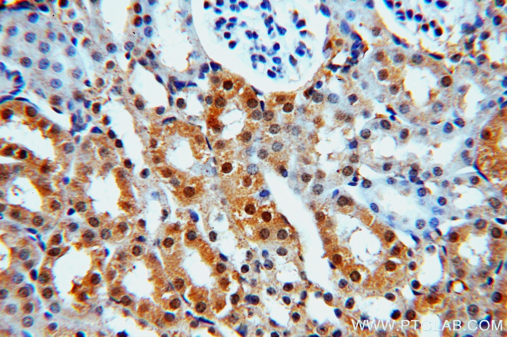 Immunohistochemistry (IHC) staining of mouse kidney tissue using MYST2 Polyclonal antibody (13751-1-AP)
