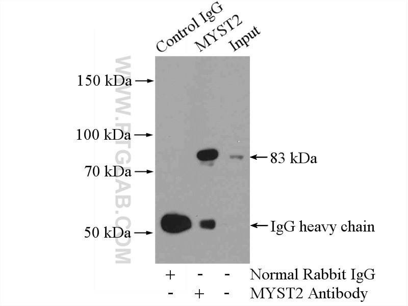 Immunoprecipitation (IP) experiment of HeLa cells using MYST2 Polyclonal antibody (13751-1-AP)
