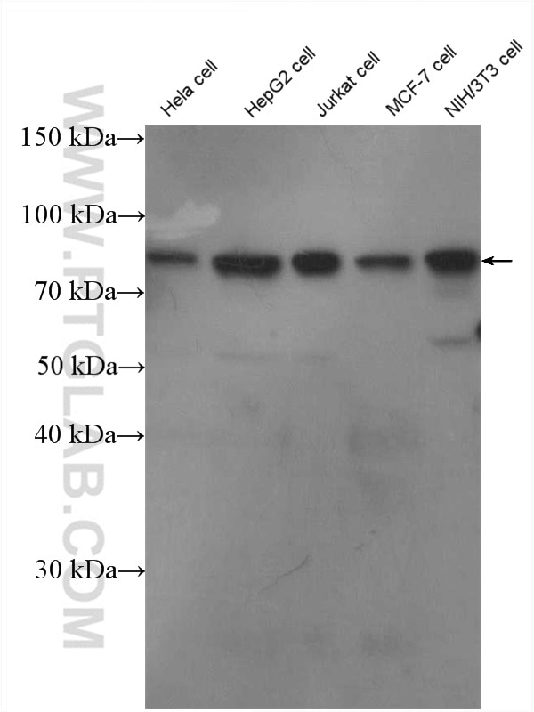 Western Blot (WB) analysis of HeLa cells using MYST2 Polyclonal antibody (13751-1-AP)