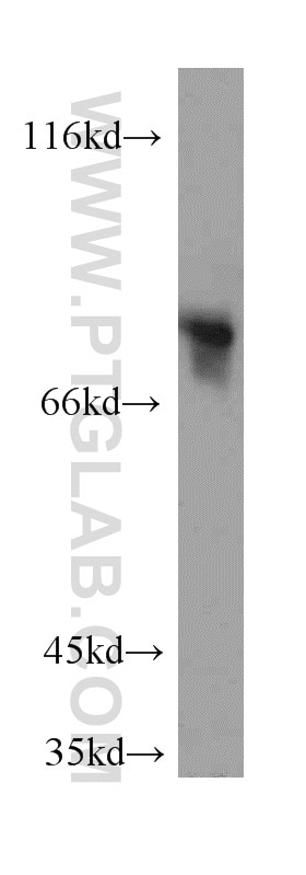 WB analysis of human testis using 13751-1-AP