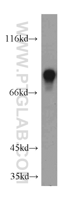 Western Blot (WB) analysis of HeLa cells using MYST2 Polyclonal antibody (13751-1-AP)