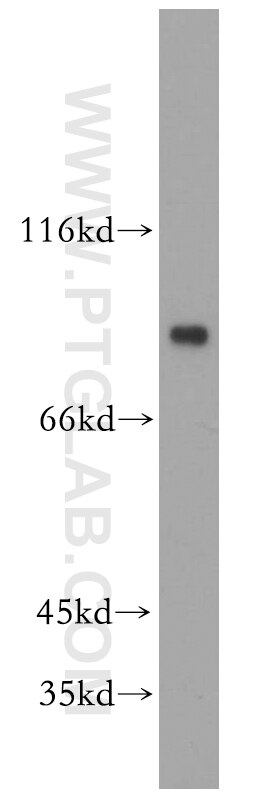 Western Blot (WB) analysis of Jurkat cells using MYST2 Polyclonal antibody (13751-1-AP)