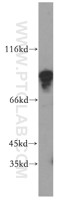 Western Blot (WB) analysis of NIH/3T3 cells using MYST2 Polyclonal antibody (13751-1-AP)