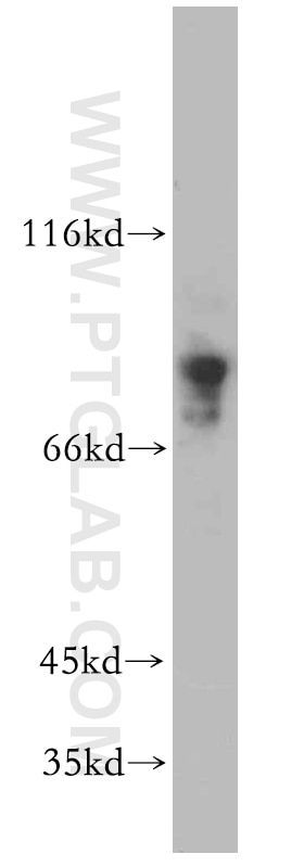 Western Blot (WB) analysis of MCF-7 cells using MYST2 Polyclonal antibody (13751-1-AP)