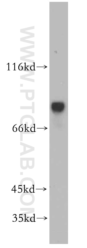 Western Blot (WB) analysis of PC-3 cells using MYST2 Polyclonal antibody (13751-1-AP)