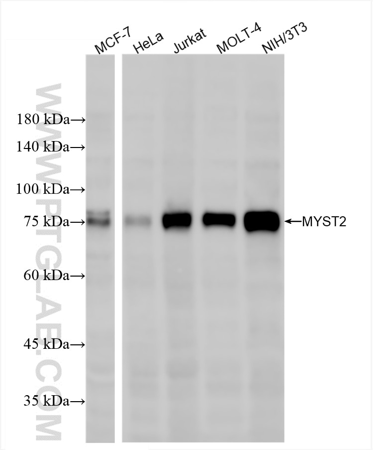 Various lysates were subjected to SDS PAGE followed by western blot with 86486-1-RR (MYST2 antibody) at dilution of 1:5000 incubated at room temperature for 1.5 hours. Western Blot (WB) analysis of various lysates using MYST2 Recombinant antibody (86486-1-RR)