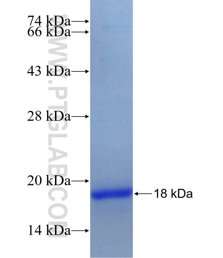 MYST3 fusion protein Ag29744 SDS-PAGE