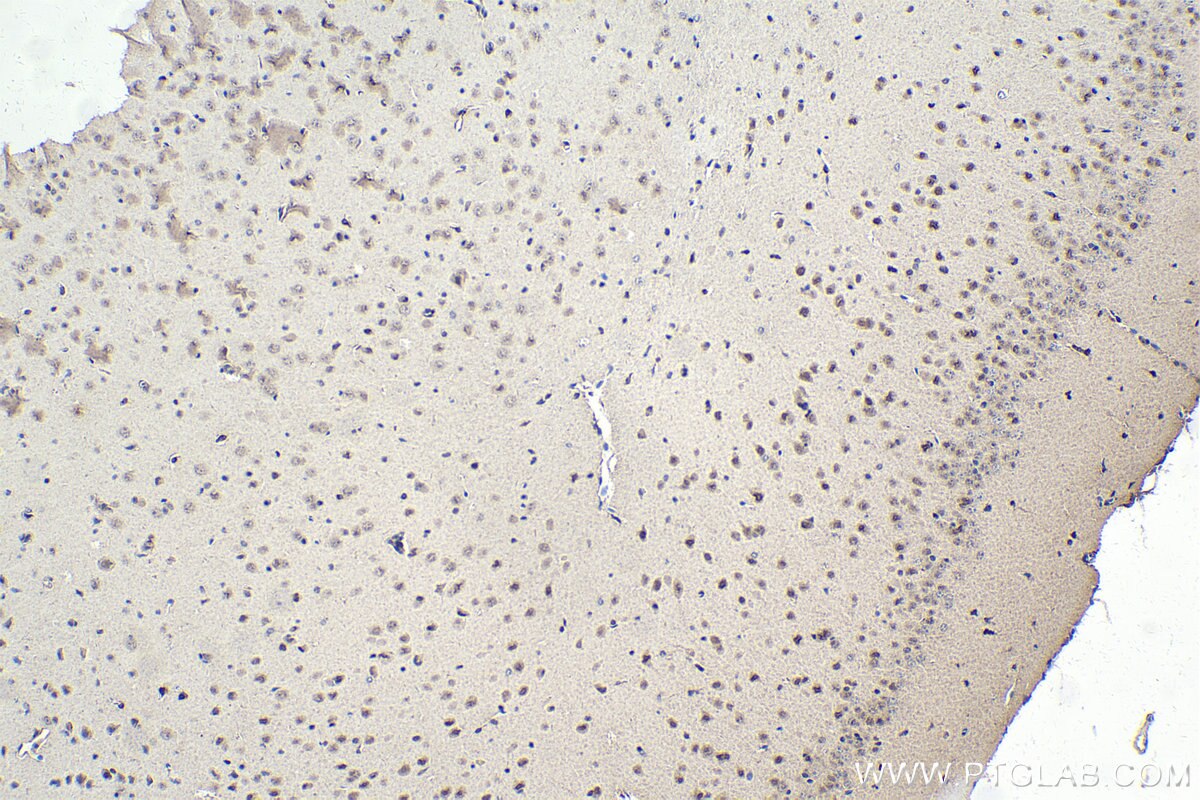 Immunohistochemistry (IHC) staining of mouse brain tissue using MYT1 Polyclonal antibody (26204-1-AP)