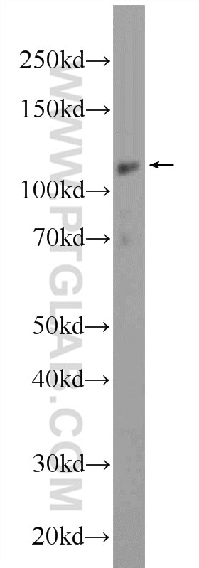 Western Blot (WB) analysis of HeLa cells using MYT1L Polyclonal antibody (25234-1-AP)