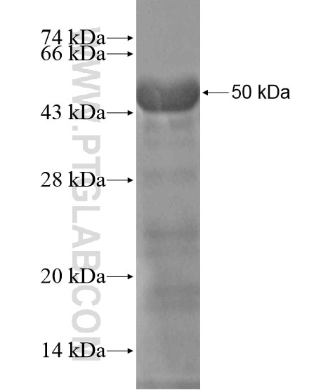 MYT1L fusion protein Ag18906 SDS-PAGE