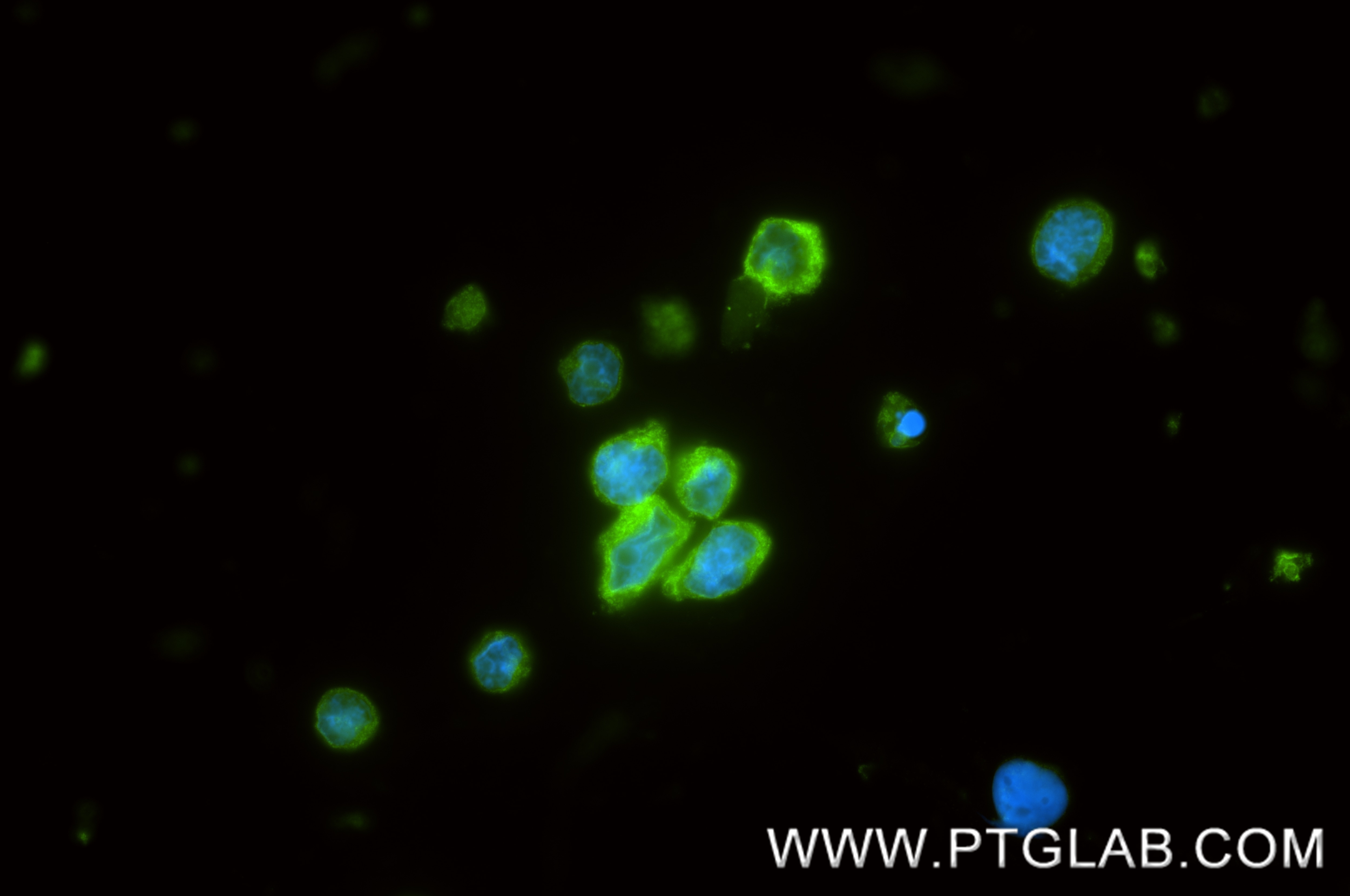 IF Staining of Raji using 88201-1-RR (same clone as 88201-1-PBS) Immunofluorescence (IF) / fluorescent staining of Raji cells using MZB1 Recombinant monoclonal antibody (88201-1-RR)