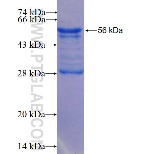 MZF1 fusion protein Ag25194 SDS-PAGE