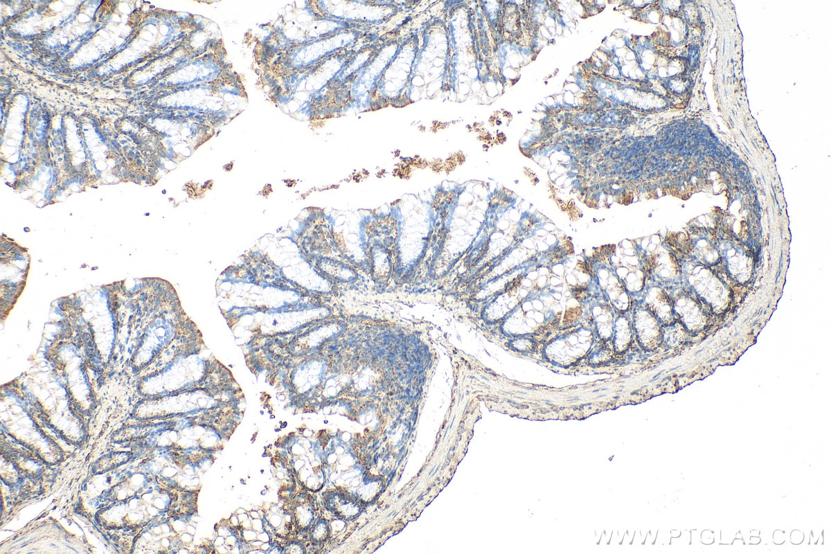 Immunohistochemical analysis of paraffin-embedded mouse colon tissue slide using 26655-1-AP (Malectin antibody) at dilution of 1:200 (under 10x lens). Heat mediated antigen retrieval with Tris-EDTA buffer (pH 9.0). Immunohistochemistry (IHC) staining of mouse colon tissue using Malectin Polyclonal antibody (26655-1-AP)