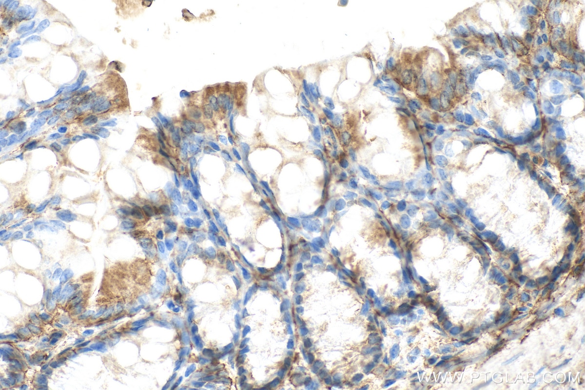 Immunohistochemical analysis of paraffin-embedded mouse colon tissue slide using 26655-1-AP (Malectin antibody) at dilution of 1:200 (under 40x lens). Heat mediated antigen retrieval with Tris-EDTA buffer (pH 9.0). Immunohistochemistry (IHC) staining of mouse colon tissue using Malectin Polyclonal antibody (26655-1-AP)