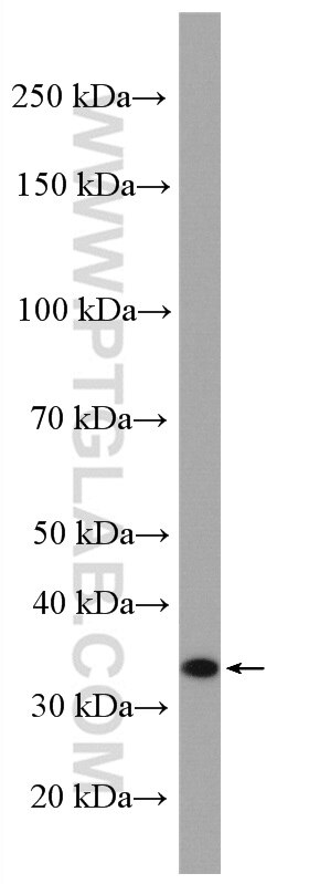 Western Blot (WB) analysis of human placenta tissue using Malectin Polyclonal antibody (26655-1-AP)