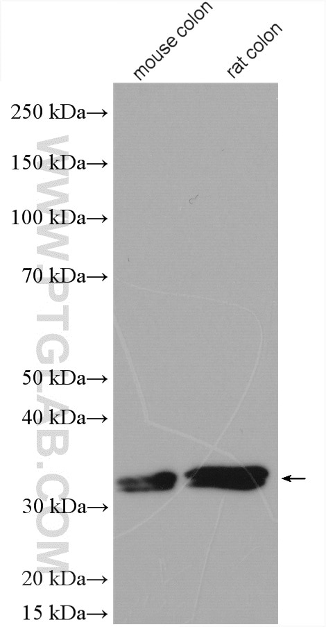 Western Blot (WB) analysis of various lysates using Malectin Polyclonal antibody (26655-1-AP)