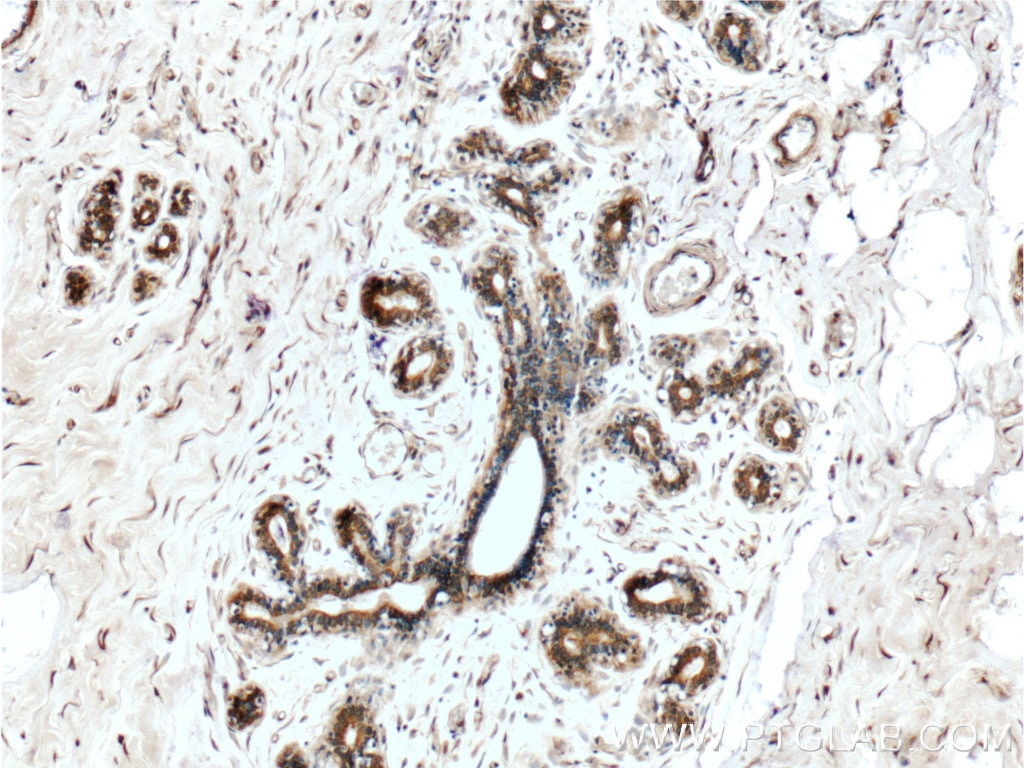 Immunohistochemistry (IHC) staining of human breast tissue using Mammaglobin A Polyclonal antibody (25645-1-AP)