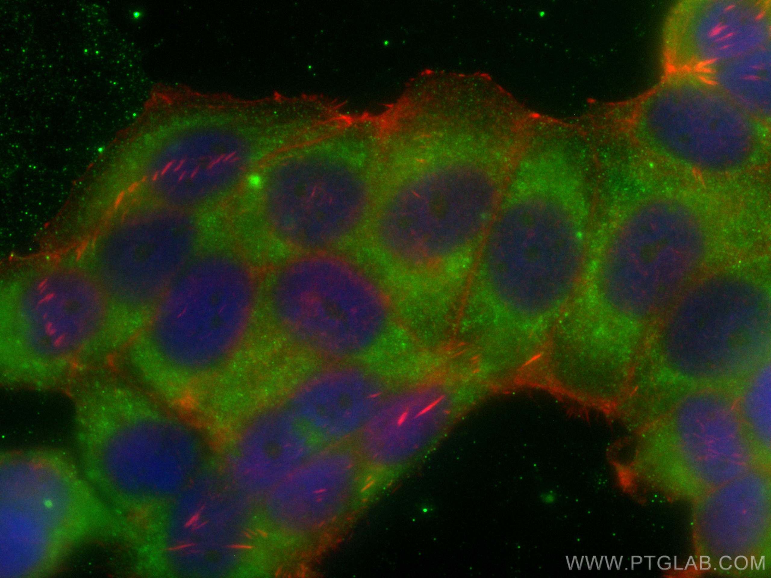 Immunofluorescence (IF) / fluorescent staining of MCF-7 cells using CoraLite® Plus 488-conjugated Mammaglobin A Monocl (CL488-66237)