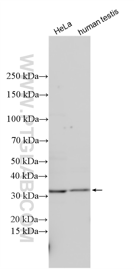 Western Blot (WB) analysis of various lysates using Marapsin2/PRSS38 Polyclonal antibody (25560-1-AP)