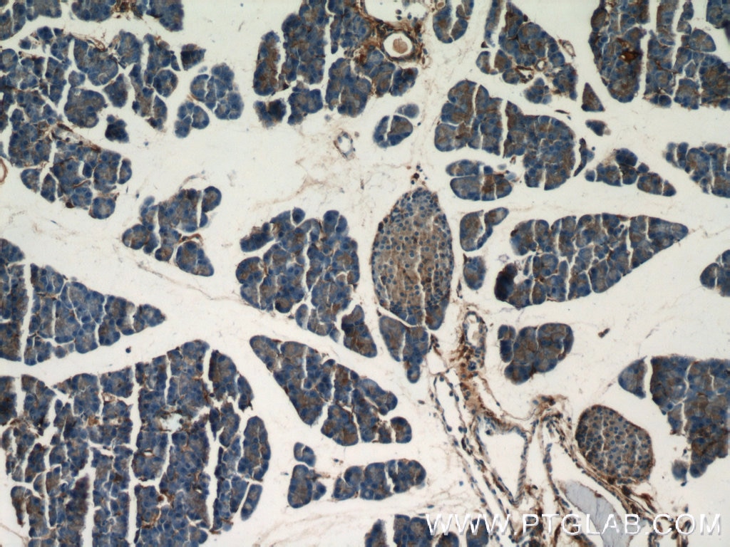 Immunohistochemistry (IHC) staining of mouse pancreas tissue using Marcks Polyclonal antibody (10004-2-Ig)