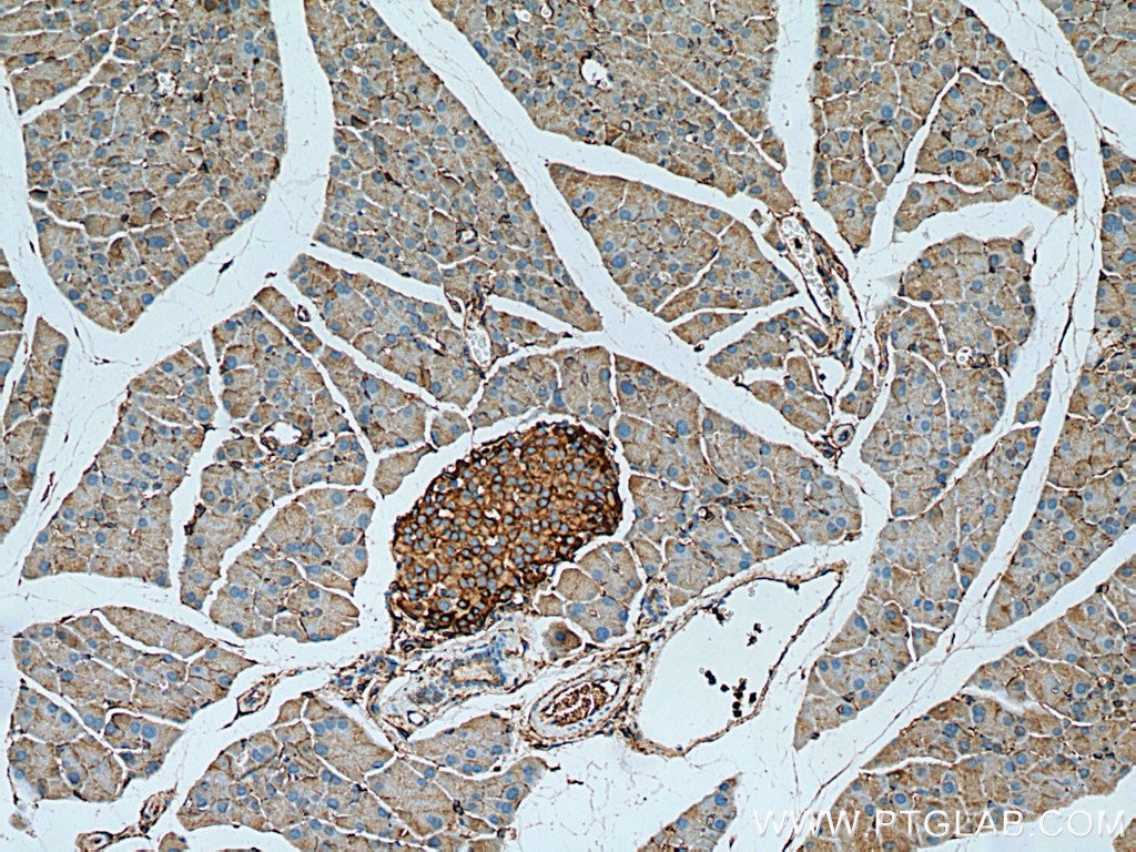 Immunohistochemistry (IHC) staining of mouse pancreas tissue using Marcks Polyclonal antibody (10004-2-Ig)