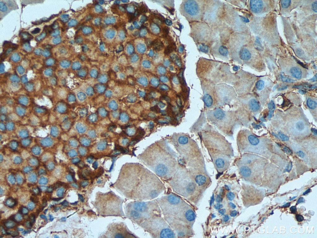 Immunohistochemistry (IHC) staining of mouse pancreas tissue using Marcks Polyclonal antibody (10004-2-Ig)