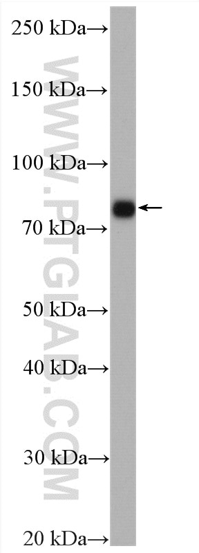 Western Blot (WB) analysis of mouse brain tissue using Marcks Polyclonal antibody (10004-2-Ig)