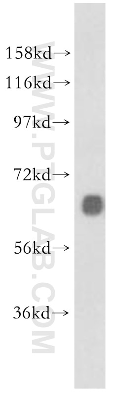 Western Blot (WB) analysis of mouse brain tissue using Marcksl1 Polyclonal antibody (10002-2-AP)