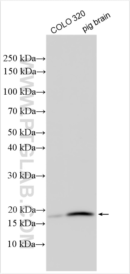 Western Blot (WB) analysis of various lysates using Maturin Polyclonal antibody (27936-1-AP)