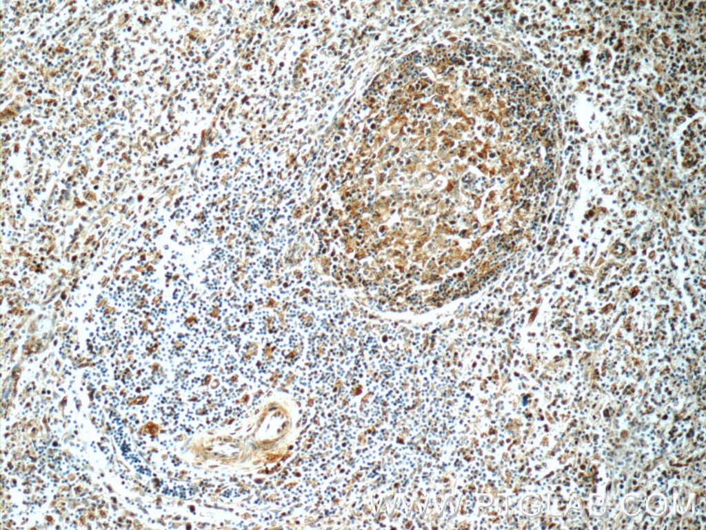 Immunohistochemistry (IHC) staining of human spleen tissue using MCL1L-specific Polyclonal antibody (15825-1-AP)