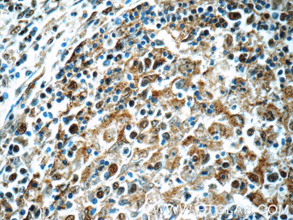 Immunohistochemistry (IHC) staining of human spleen tissue using MCL1L-specific Polyclonal antibody (15825-1-AP)