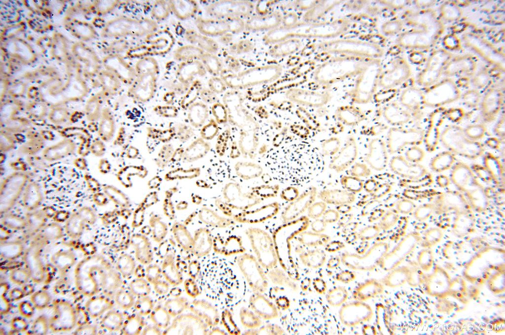 Immunohistochemistry (IHC) staining of human kidney tissue using MCL1L-specific Polyclonal antibody (15825-1-AP)