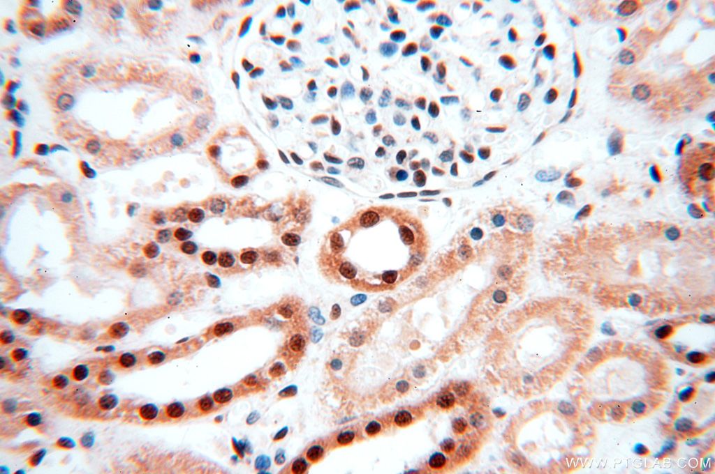 Immunohistochemistry (IHC) staining of human kidney tissue using MCL1L-specific Polyclonal antibody (15825-1-AP)