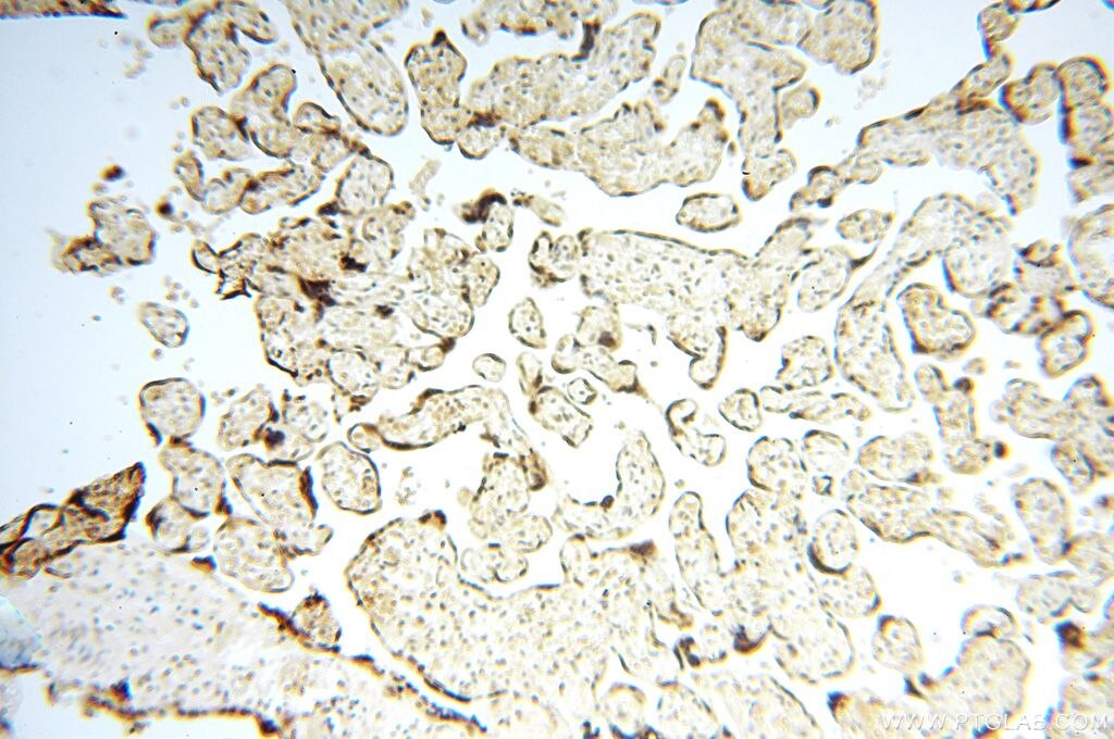 IHC staining of human placenta using 15825-1-AP