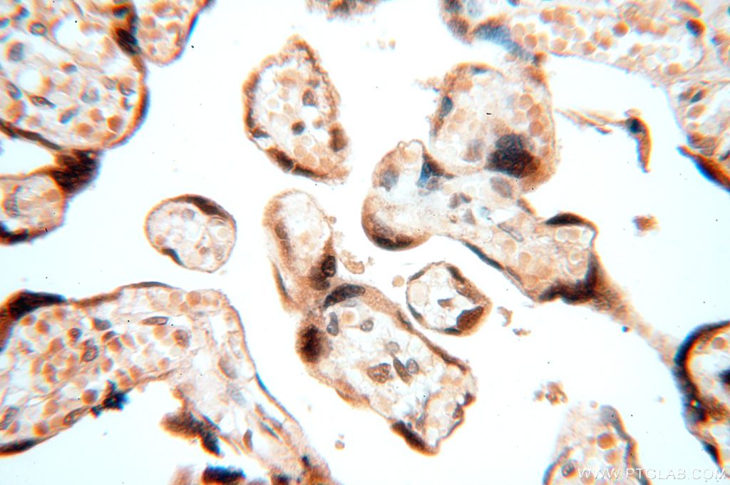Immunohistochemistry (IHC) staining of human placenta tissue using MCL1L-specific Polyclonal antibody (15825-1-AP)
