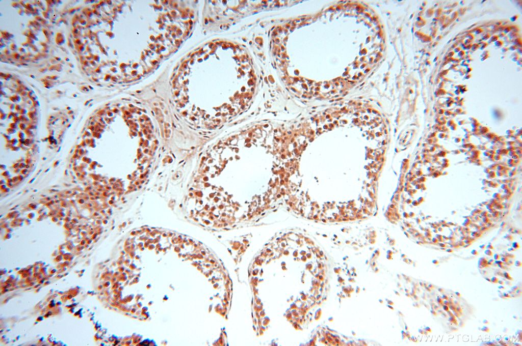 Immunohistochemistry (IHC) staining of human testis tissue using MCL1L-specific Polyclonal antibody (15825-1-AP)
