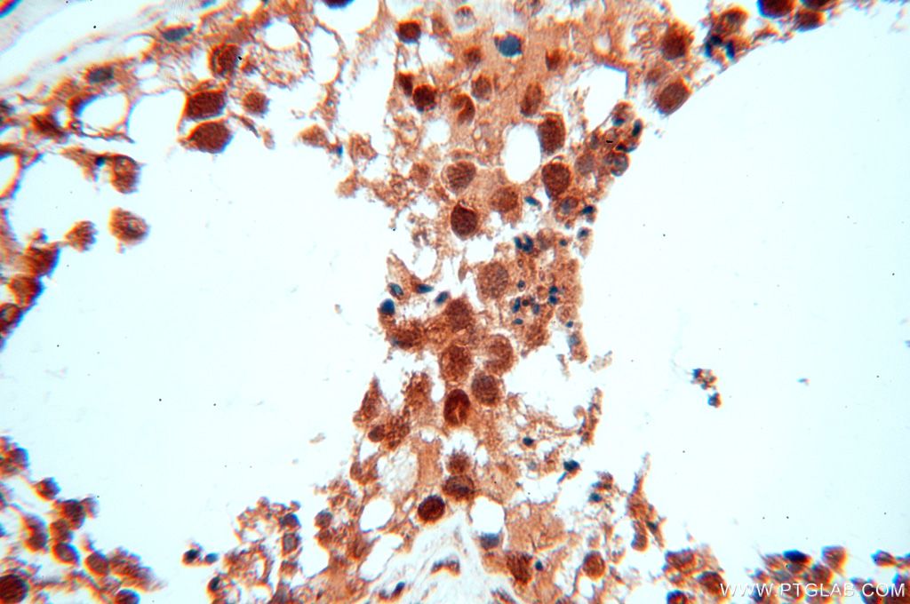 Immunohistochemistry (IHC) staining of human testis tissue using MCL1L-specific Polyclonal antibody (15825-1-AP)