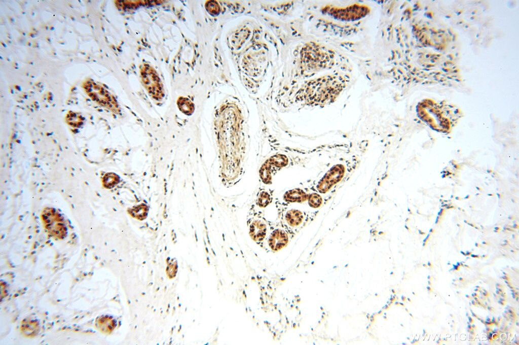 Immunohistochemistry (IHC) staining of human skin tissue using MCL1L-specific Polyclonal antibody (15825-1-AP)