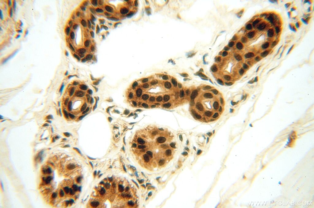 IHC staining of human skin using 15825-1-AP