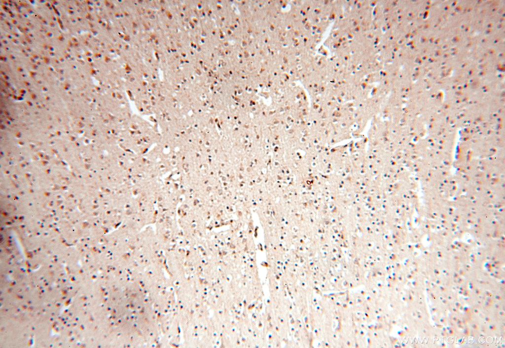 Immunohistochemistry (IHC) staining of human brain tissue using MCL1L-specific Polyclonal antibody (15825-1-AP)