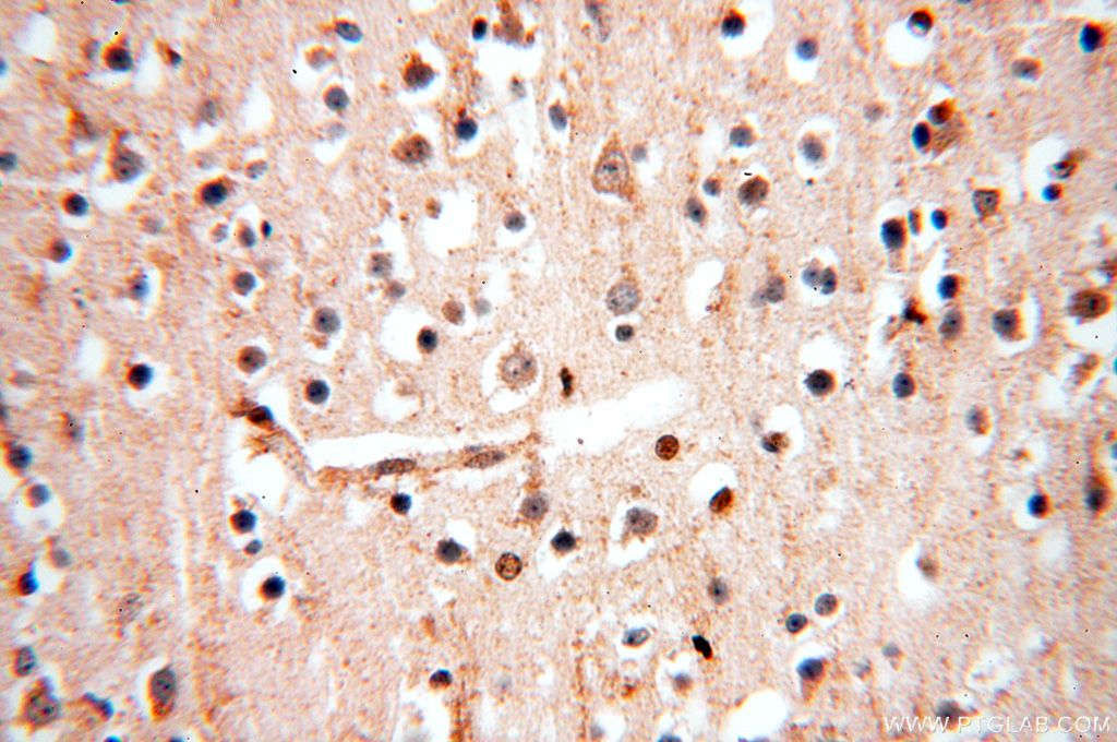 Immunohistochemistry (IHC) staining of human brain tissue using MCL1L-specific Polyclonal antibody (15825-1-AP)