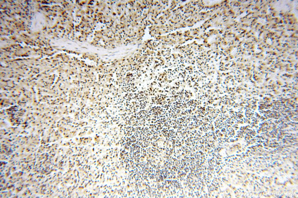 Immunohistochemistry (IHC) staining of human spleen tissue using MCL1L-specific Polyclonal antibody (15825-1-AP)