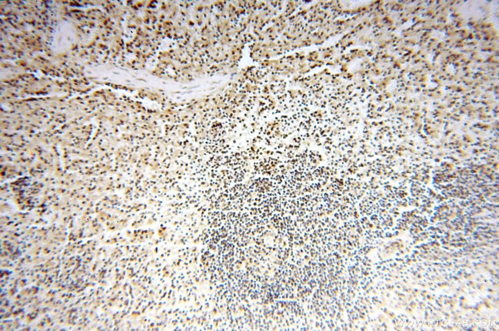 IHC staining of human spleen using 15825-1-AP