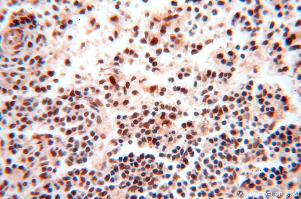 Immunohistochemistry (IHC) staining of human spleen tissue using MCL1L-specific Polyclonal antibody (15825-1-AP)