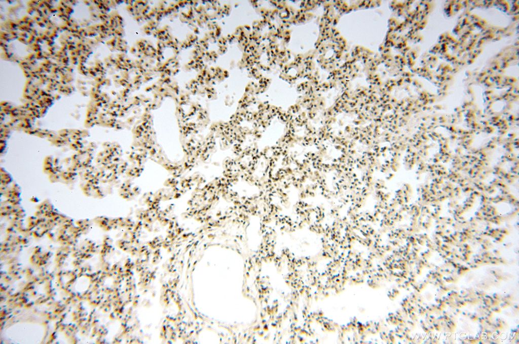 IHC staining of human lung using 15825-1-AP