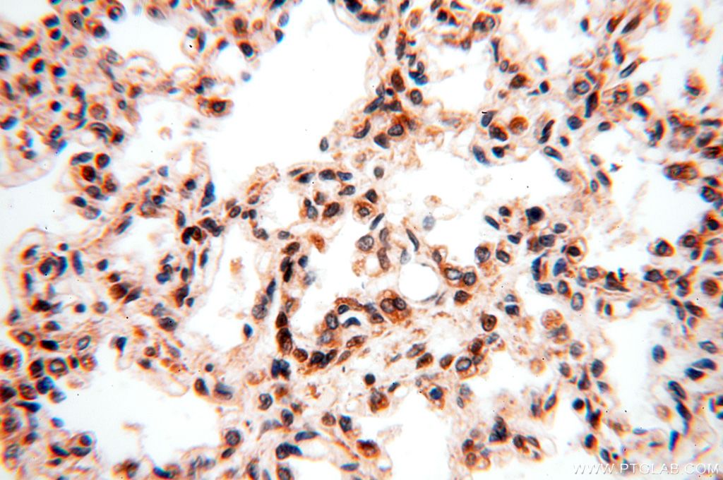 Immunohistochemistry (IHC) staining of human lung tissue using MCL1L-specific Polyclonal antibody (15825-1-AP)