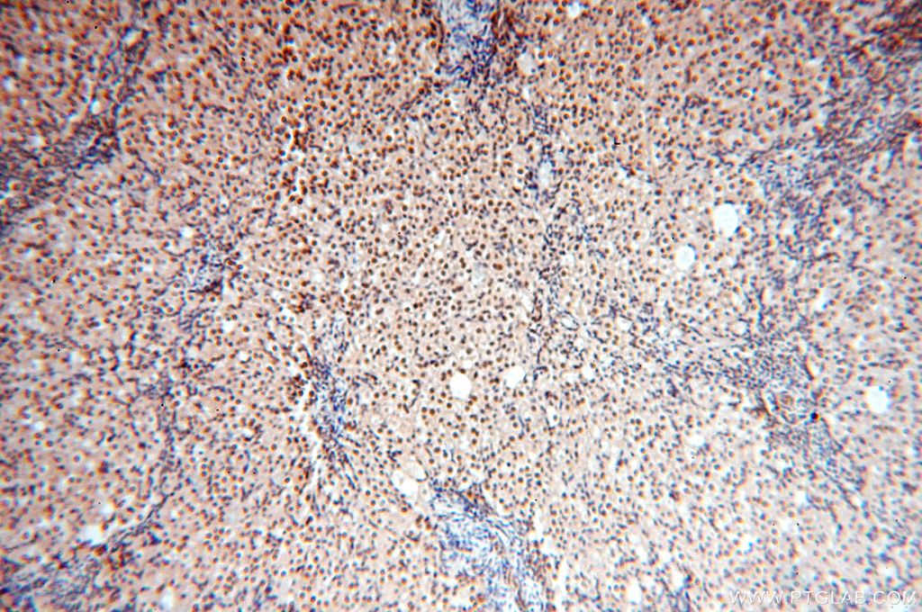 Immunohistochemistry (IHC) staining of human ovary tissue using MCL1L-specific Polyclonal antibody (15825-1-AP)